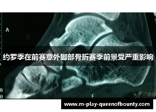 约罗季在前赛意外脚部骨折赛季前景受严重影响